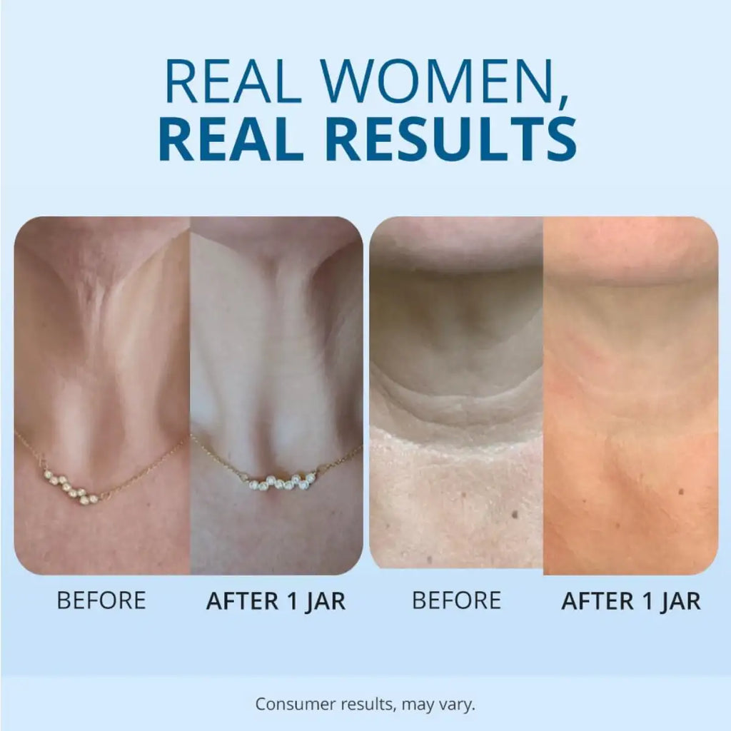 Before and after comparison of neck skin texture with a necklace, on a light blue background.