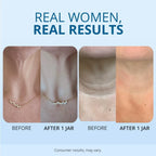 Before and after comparison of neck skin texture with a necklace, on a light blue background.