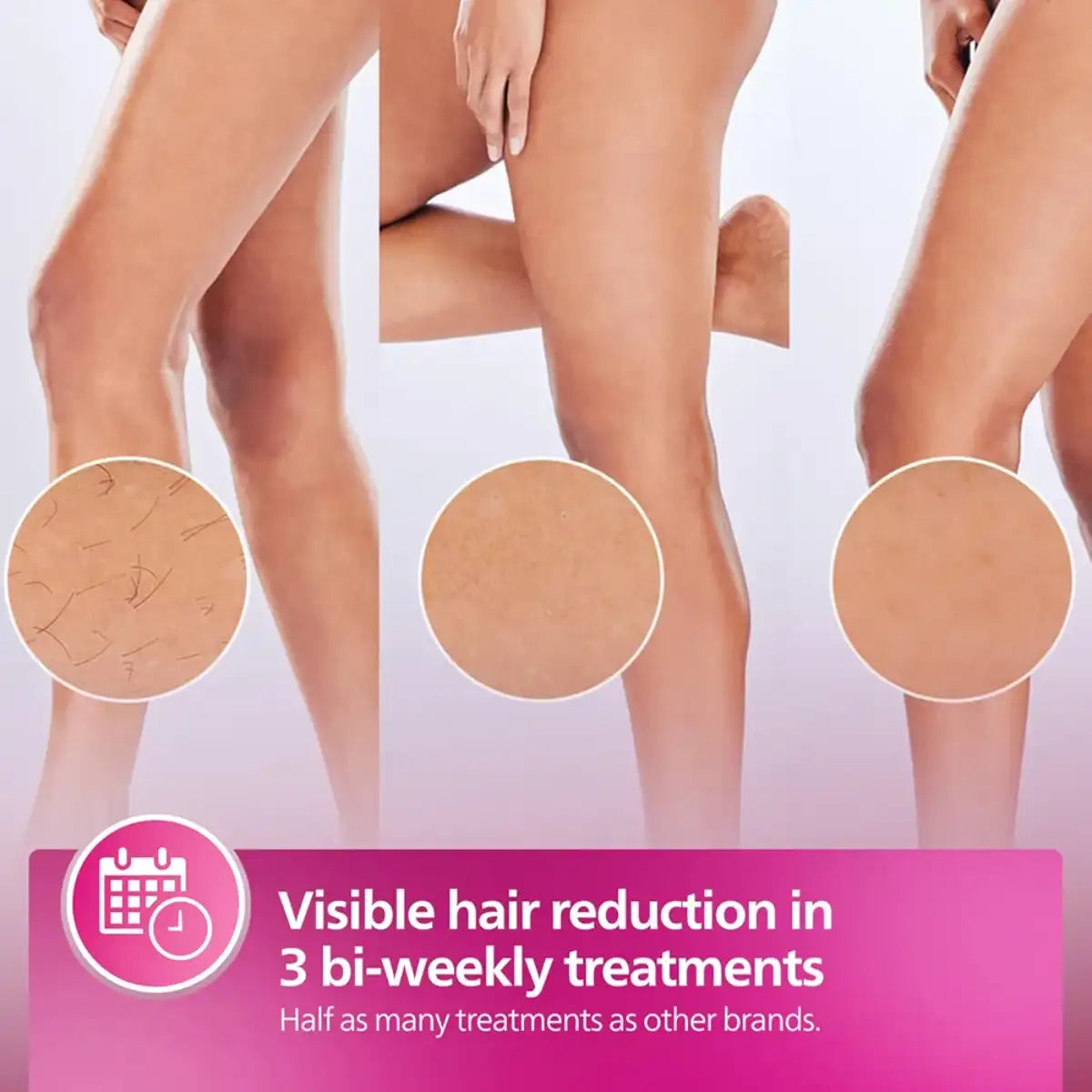 Advertisement showing legs with hair reduction treatment results and text about treatment frequency.