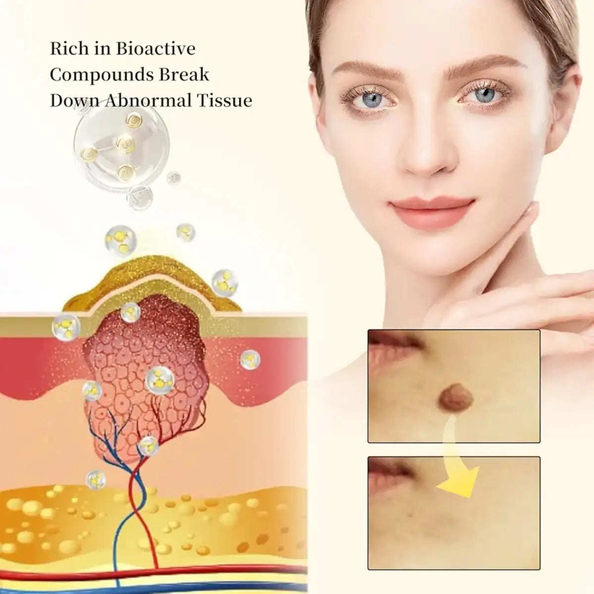 Illustration of skin with text about bioactive compounds breaking down abnormal tissue, alongside a close-up of a woman's face.
